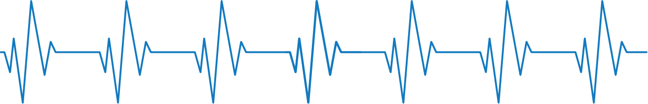 EKG